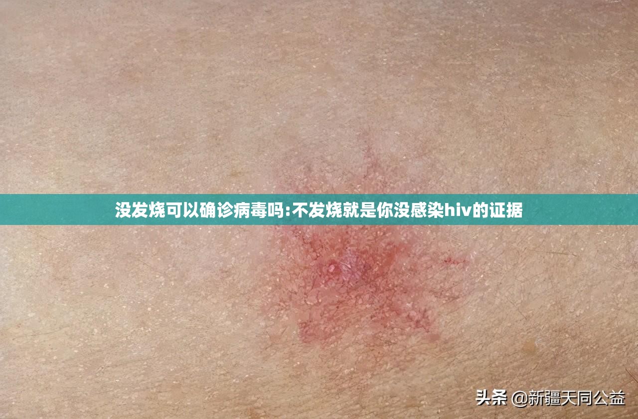 没发烧可以确诊病毒吗:不发烧就是你没感染hiv的证据