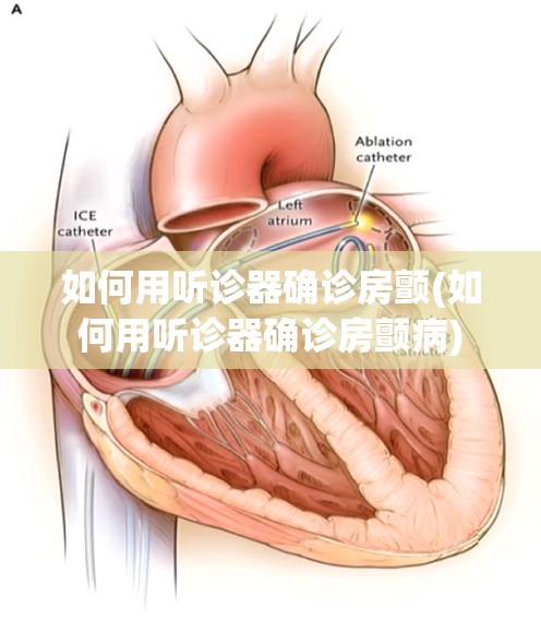 如何用听诊器确诊房颤(如何用听诊器确诊房颤病) 如何用听诊器确诊房颤(如何用听诊器确诊房颤病)