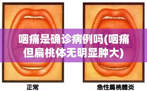 咽痛是确诊病例吗(咽痛但扁桃体无明显肿大)